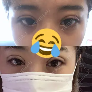 7日目の経過画像（2枚目）