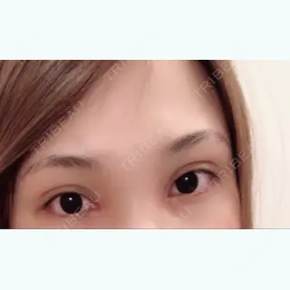 27日目の経過画像（1枚目）