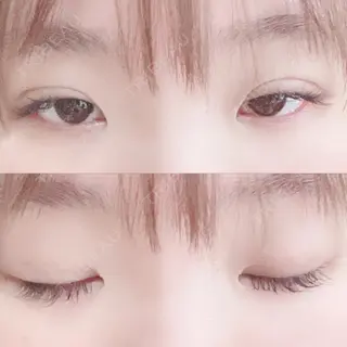 4日目の経過画像（1枚目）