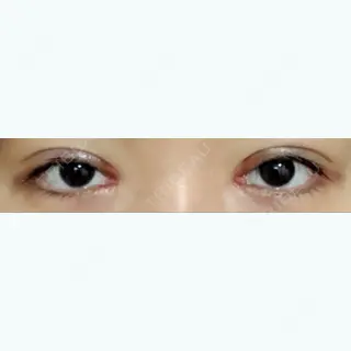 18日目の経過画像（1枚目）