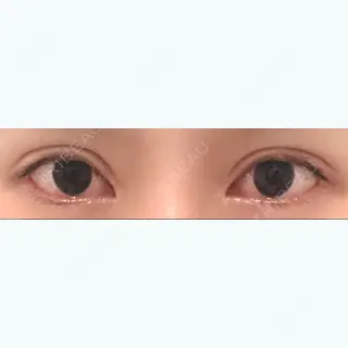 265日目の経過画像（1枚目）