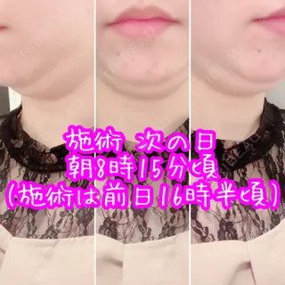 1日目の経過画像（1枚目）