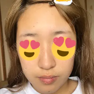 1日目の経過画像（1枚目）
