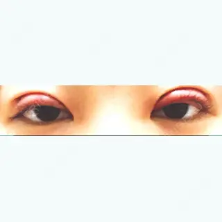 0日目の経過画像（1枚目）
