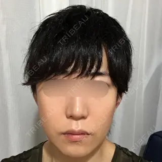 10日目の経過画像（1枚目）