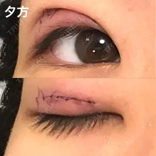 3日目の経過画像（3枚目）