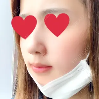 7日目の経過画像（2枚目）