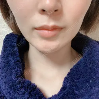 18日目の経過画像（1枚目）