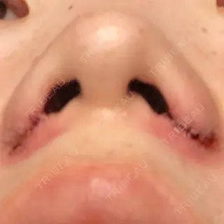 2日目の経過画像（2枚目）