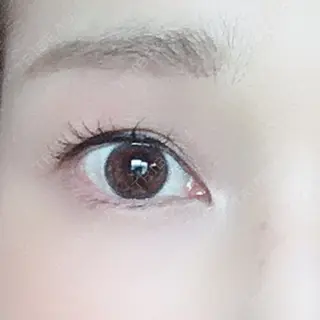 29日目の経過画像（1枚目）