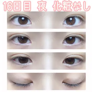 16日目の経過画像（1枚目）