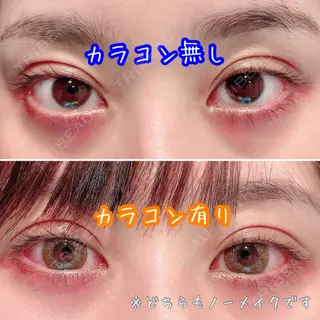 2日目の経過画像（1枚目）