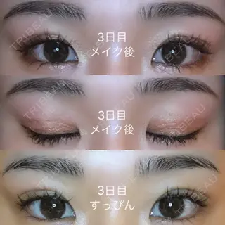 3日目の経過画像（2枚目）