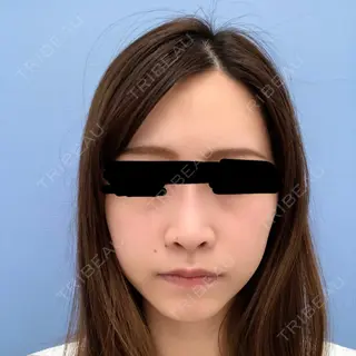 25日目の経過画像（2枚目）