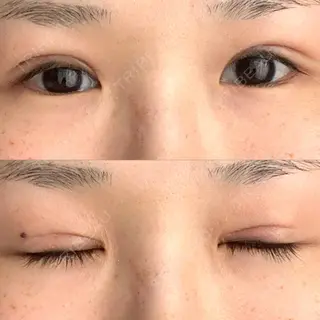 18日目の経過画像（1枚目）