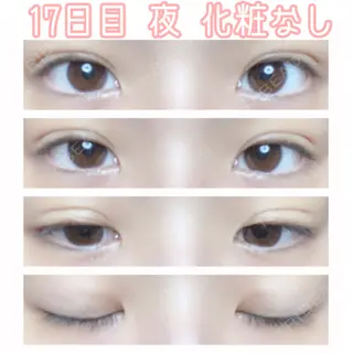 17日目の経過画像（1枚目）