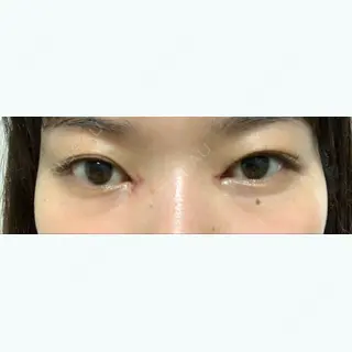 7日目の経過画像（1枚目）