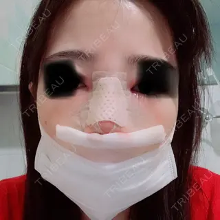 0日目の経過画像（1枚目）