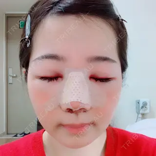 1日目の経過画像（1枚目）