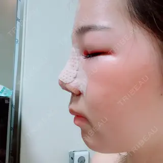 1日目の経過画像（2枚目）