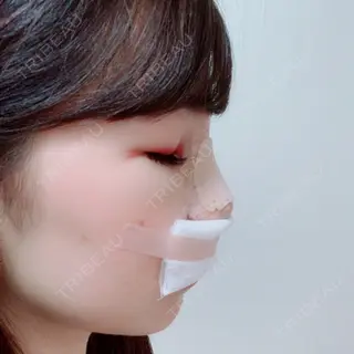 2日目の経過画像（2枚目）