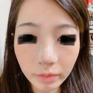 12日目の経過画像（1枚目）