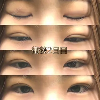 1日目の経過画像（1枚目）
