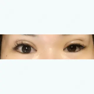 19日目の経過画像（1枚目）