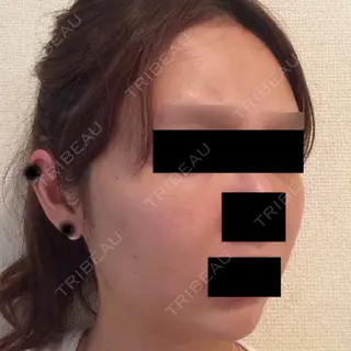 8日目の経過画像（2枚目）