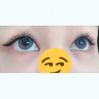 13日目の経過画像（2枚目）