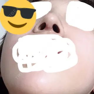 9日目の経過画像（1枚目）