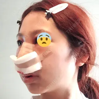 2日目の経過画像（2枚目）