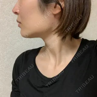 21日目の経過画像（2枚目）
