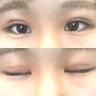 7日目の経過画像（1枚目）