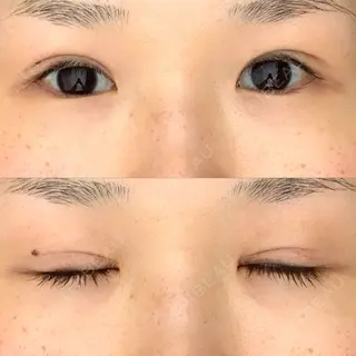 21日目の経過画像（1枚目）