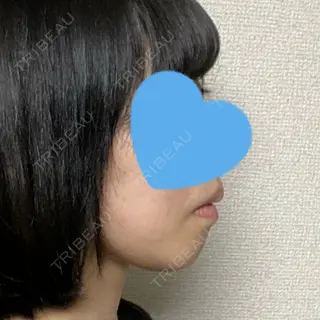 40日目の経過画像（1枚目）