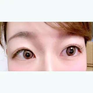 305日目の経過画像（1枚目）