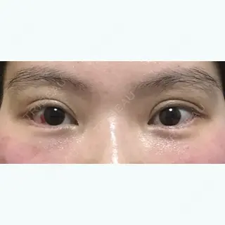 21日目の経過画像（1枚目）