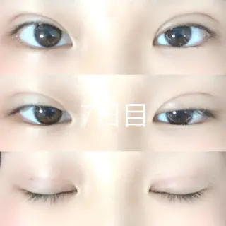 7日目の経過画像（1枚目）