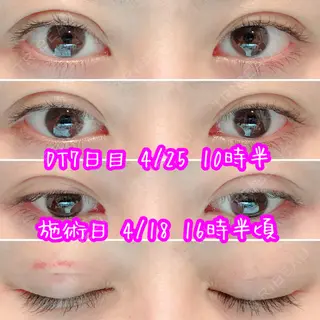 7日目の経過画像（1枚目）