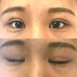 9日目の経過画像（1枚目）
