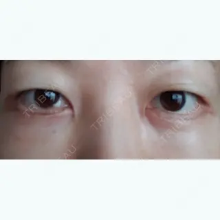21日目の経過画像（1枚目）