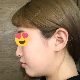 7日目の経過画像（2枚目）