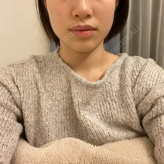 3日目の経過画像（1枚目）