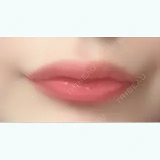 2日目の経過画像（2枚目）