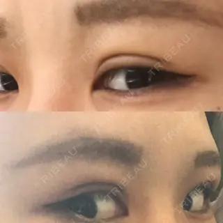 10日目の経過画像（2枚目）