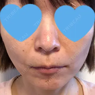 1日目の経過画像（1枚目）