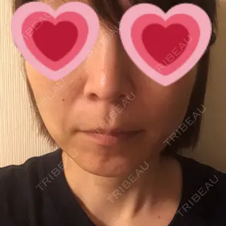 2日目の経過画像（1枚目）
