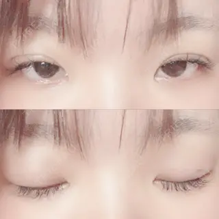 10日目の経過画像（1枚目）