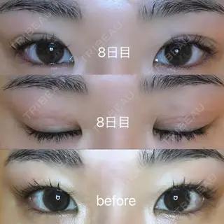 8日目の経過画像（1枚目）